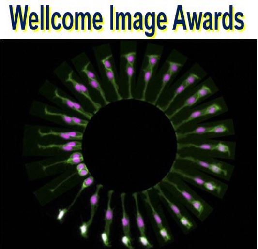 Wellcome Image Awards