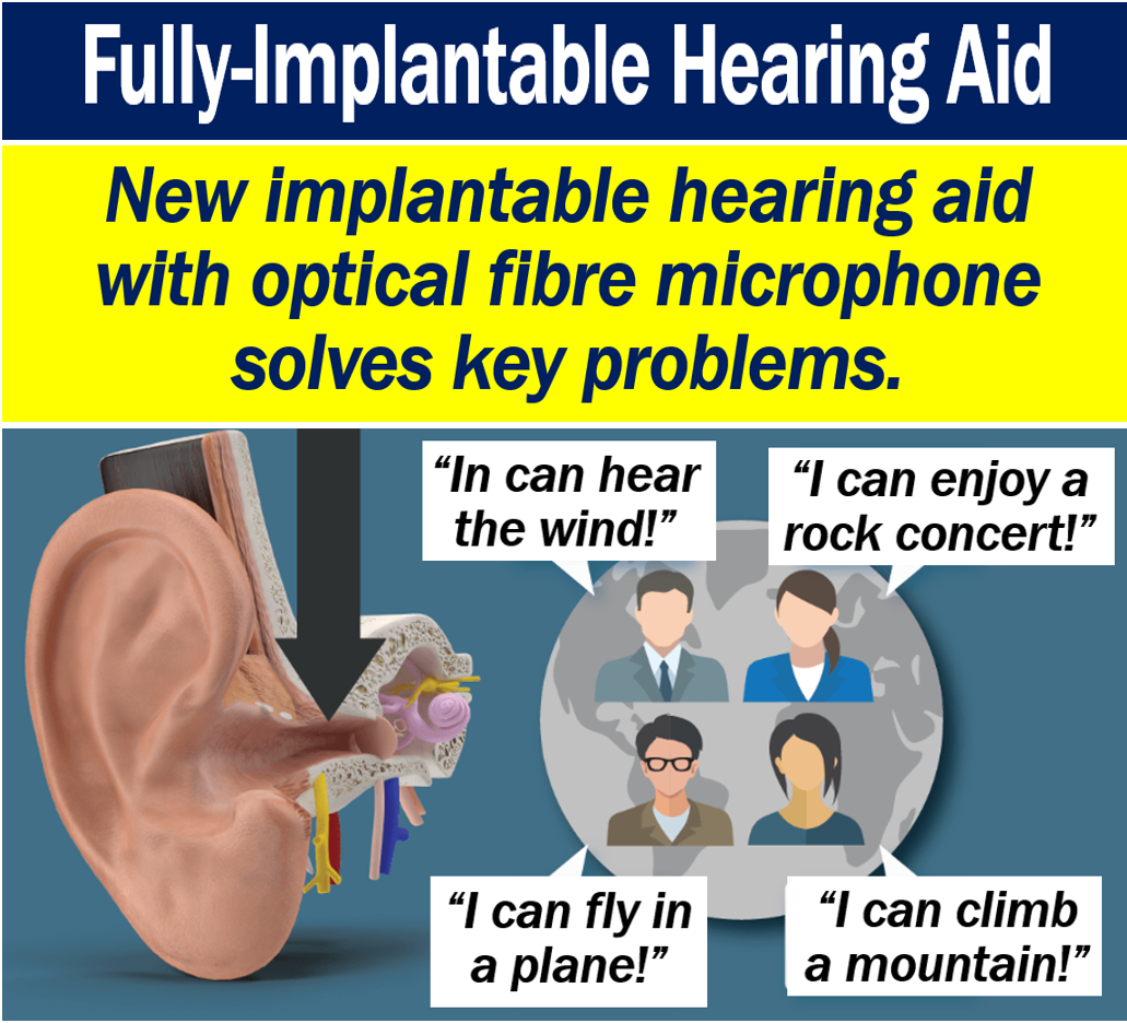 Fully-implantable hearing aid