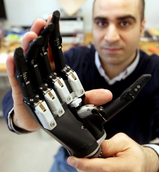 Bionic Hand