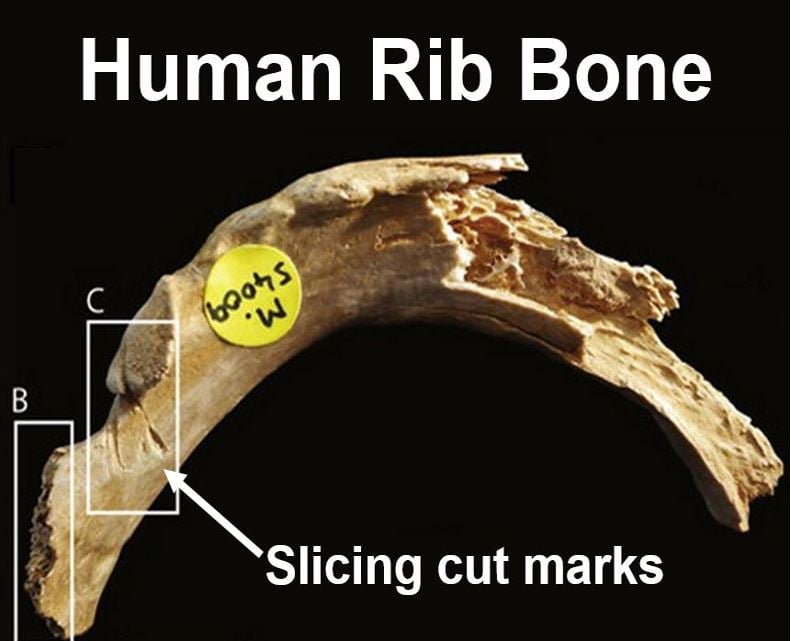 Human rib bone