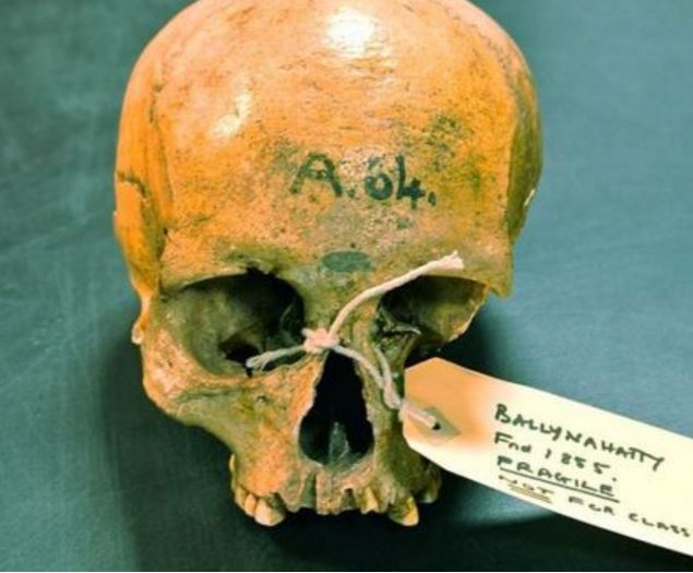 Genome of ancient Irish people Skull