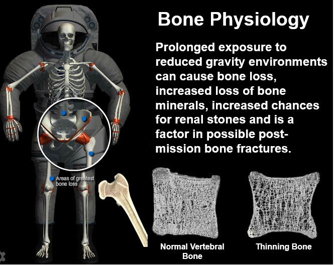 Thinning bones astronauts