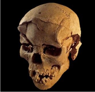 Skull with lesions evidence of prehistoric warfare