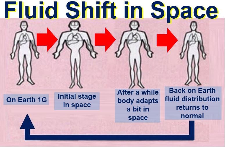 Fluid shift in microgravity of space
