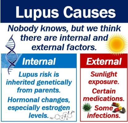 Lupus Causes