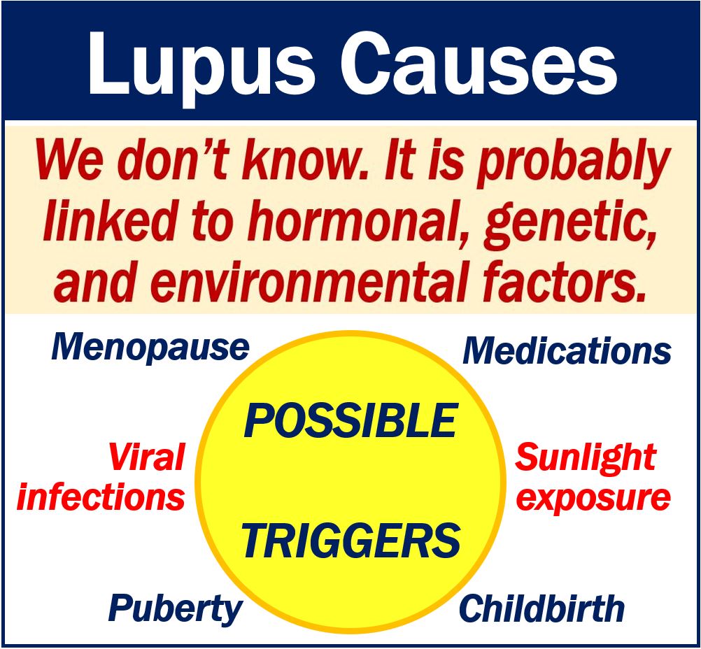 Lupus Causes