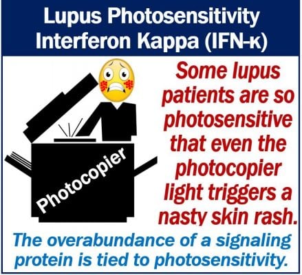 Lupus Photosensitivity - Interferon Kappa