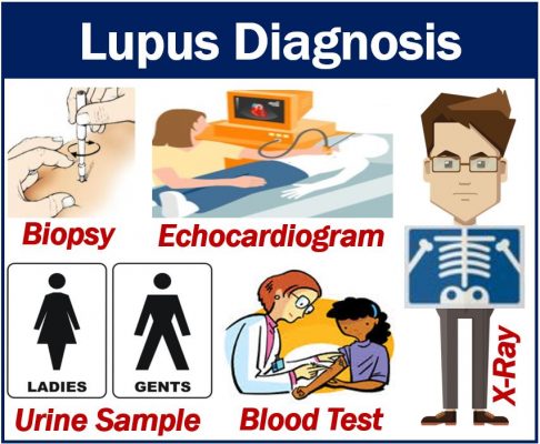 Lupus diagnosis