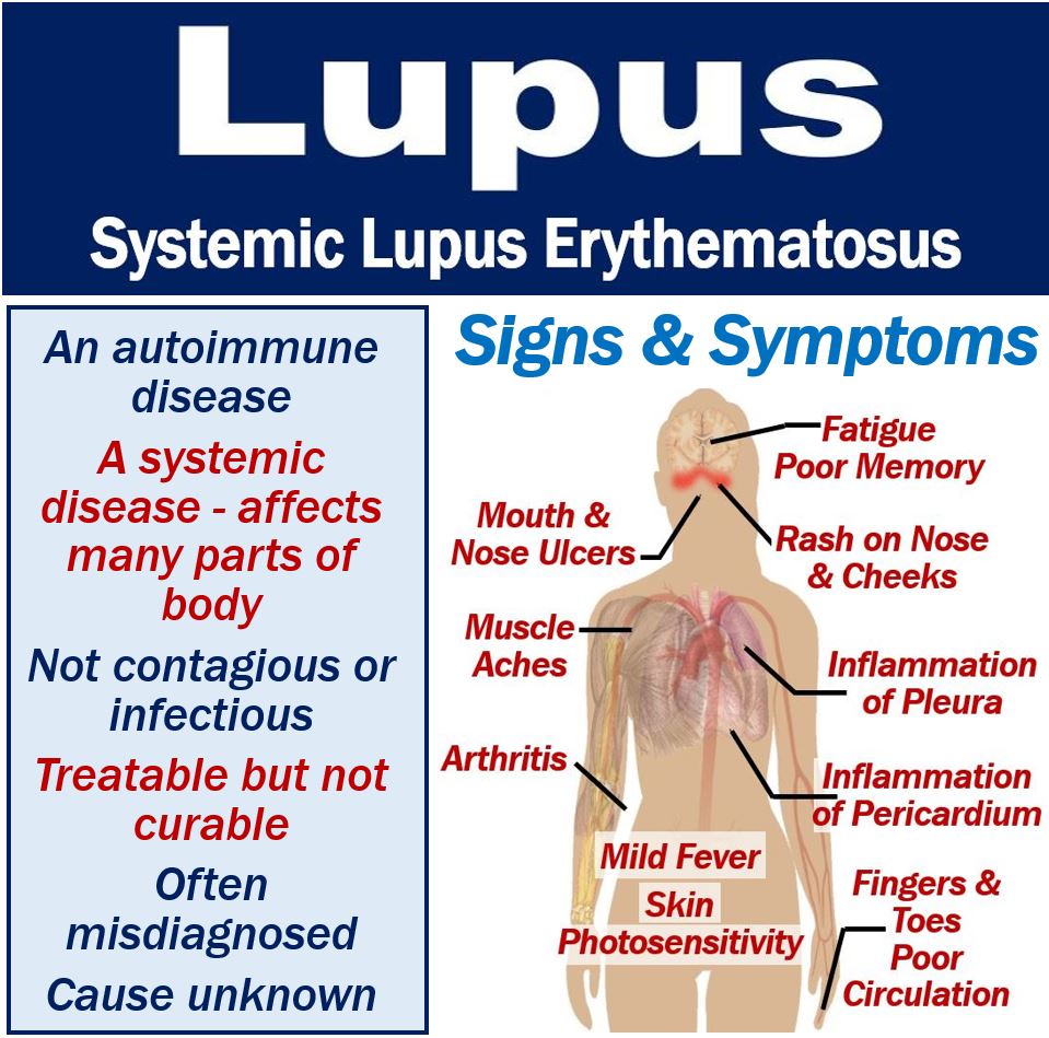 What Is Lupus Symptoms Causes Diagnosis And Treatment MBN Health