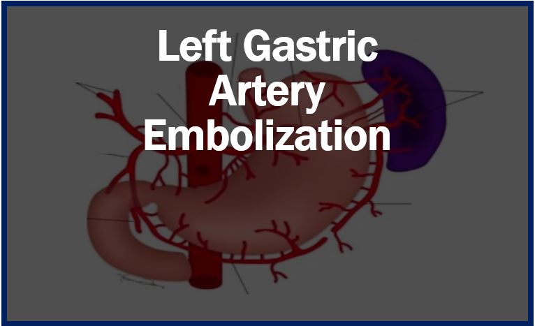 Left Gastric Artery Embolization thumbnail