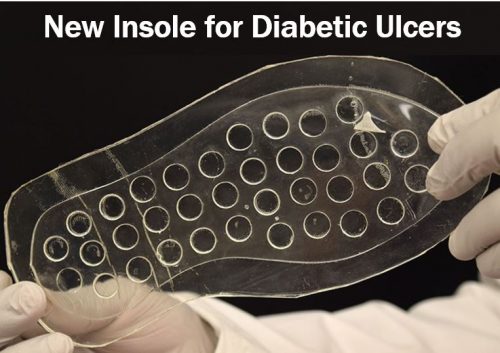 New insole for diabetic ulcers