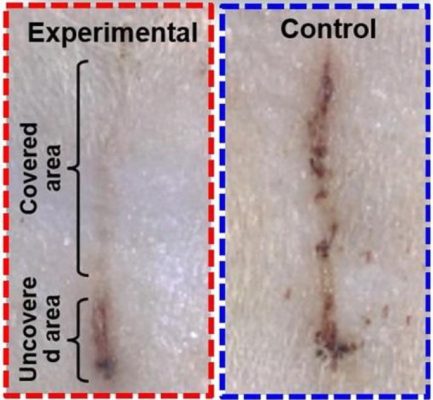 E-bandage image