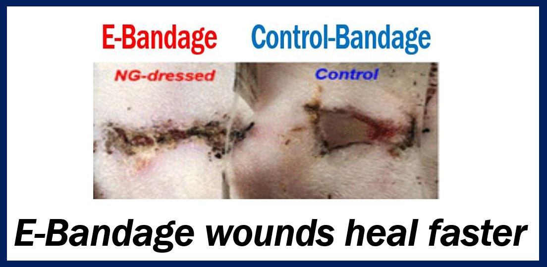 E-bandage thumbnail