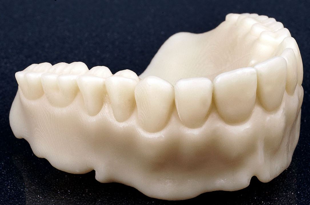 sample dental model files for 3d printing