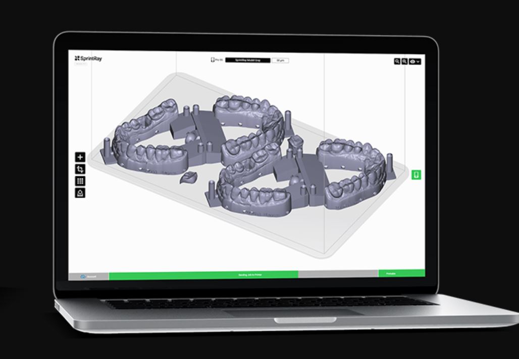 Dental 3D printing - thumbnail