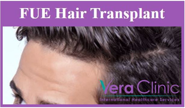 Hair Transplant image j44j4j4j