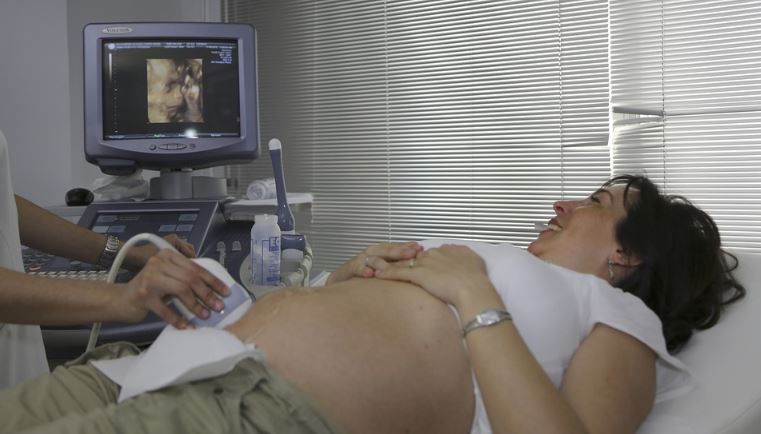 4D ultrasound scan image 44444