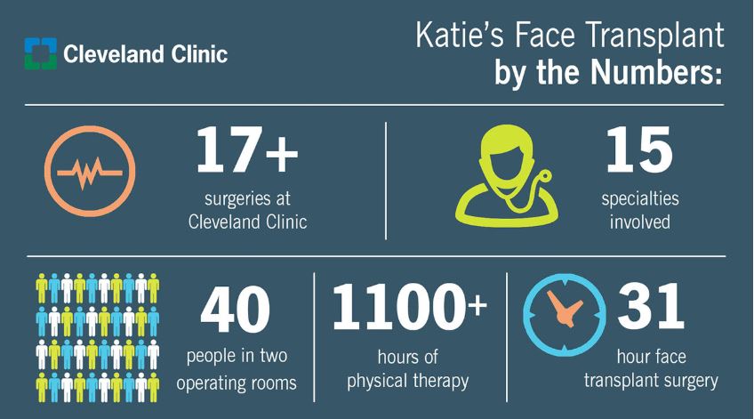 Katie face transplant by numbers - inspiring health care stories image 399393
