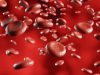 Prevention and Treatment: How to Prevent Blood Clots