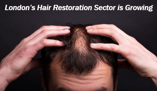 London hair restoration clinics seeing growth