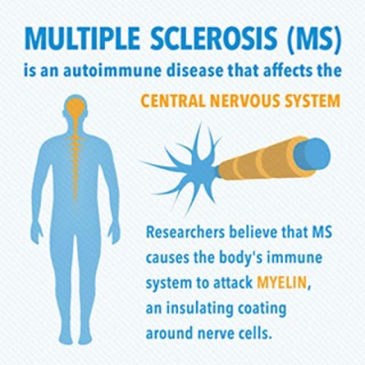 research articles in multiple sclerosis