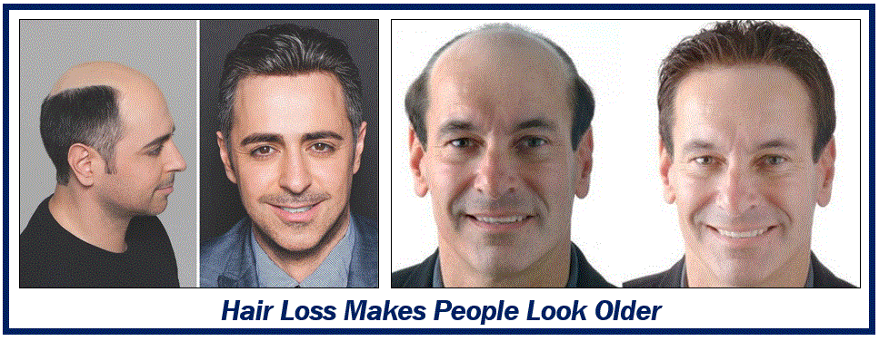 Hair loss makes people look older -