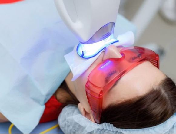 Laser teeth whitening - article on cosmetic dentisty 4993455