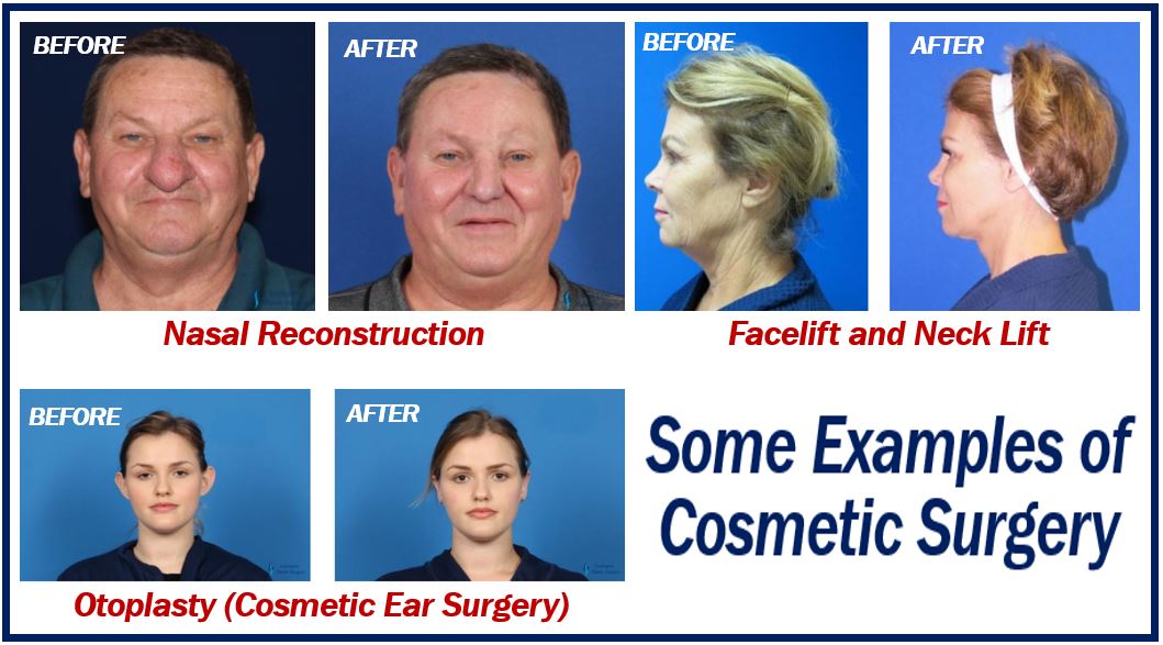 Examples of cosmetic surgery - 494938382929