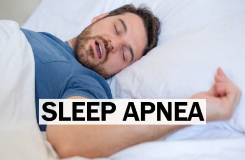 Understanding Sleep Apnea: Prevalence Among Singaporeans and When to ...