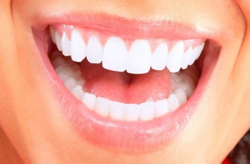 Smile - white teeth - Dentist in Maroubra - 398398983