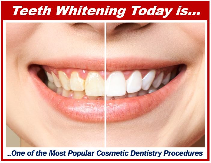 Teeth Whitening - Top Treatments and Trends in Cosmetic Dentistry