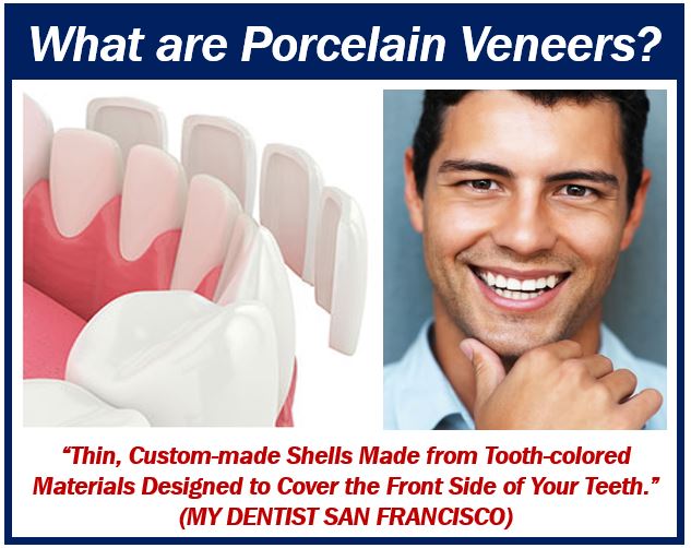 What are porcelain veneers - image for article