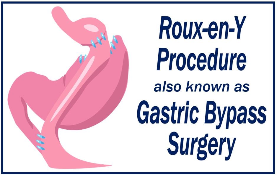 What is the Roux-en-Y procedure