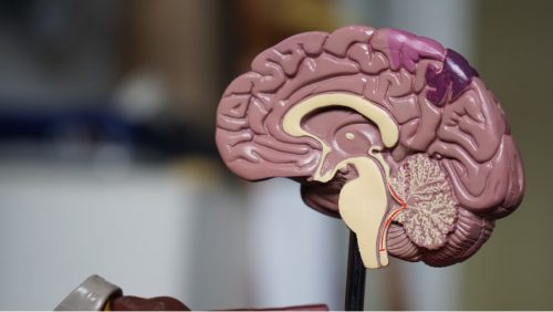 Plastic model of the human brain