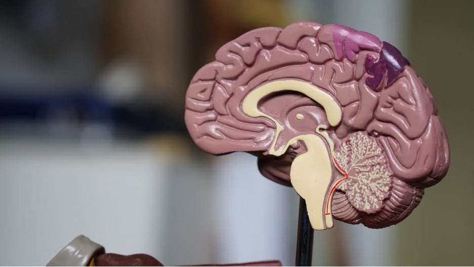 Plastic model of the human brain