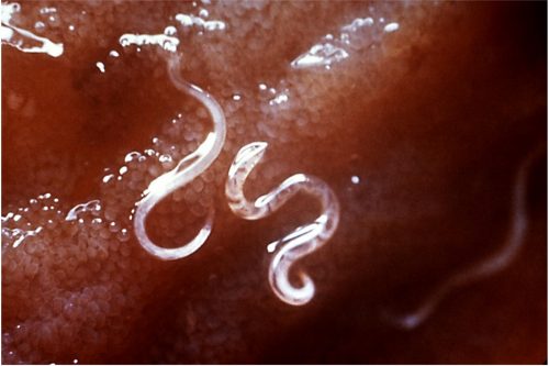 Hookworms in the human intestine