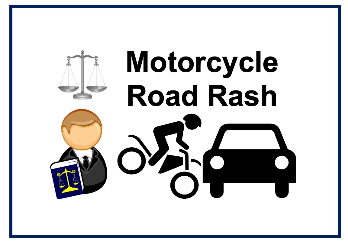 Should I Speak with a Lawyer About My Motorcycle Road Rash?