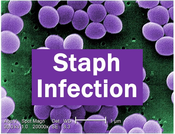 What is a Staph Infection? Causes, treatment, and complications