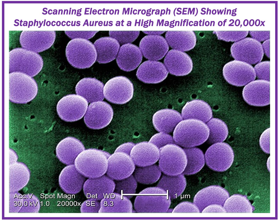 Super-magnified image of Staphylococcus aureus bacteria