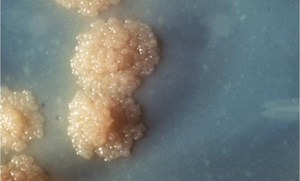 Mycobacterium tuberculosis - thumbnail image